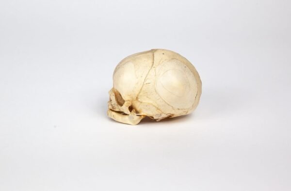 Fetal Skull - Image 3