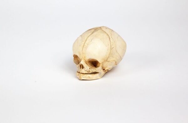 Fetal Skull - Image 2