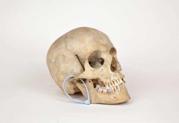 Uncut Medical Skull (0301) - Image 2