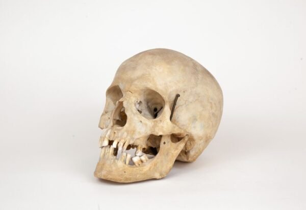 Uncut Medical Skull (0301) - Image 3