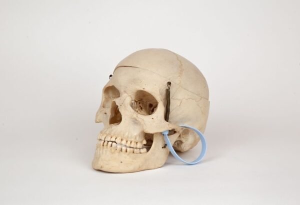 Medical Skull (0302) - Image 2