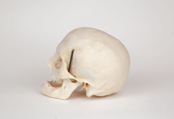 Uncut Geriatric Skull (0279) - Image 2