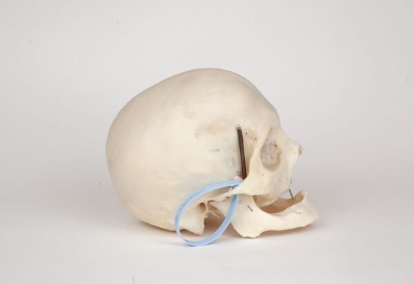 Uncut Geriatric Skull (0279) - Image 3