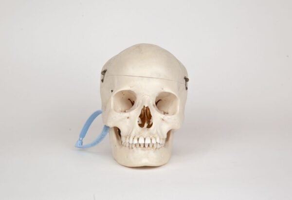 Medical Skull with Fused Atlas (0276)