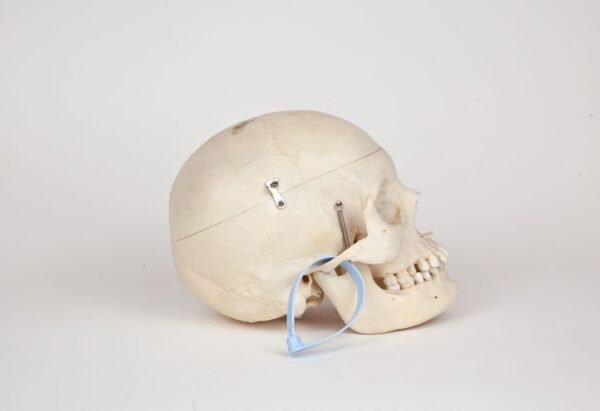 Medical Skull with Fused Atlas (0276) - Image 3