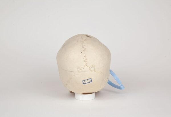 Medical Skull with Fused Atlas (0276) - Image 4