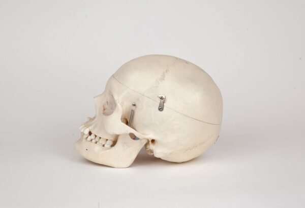 Medical Skull with Fused Atlas (0276) - Image 2
