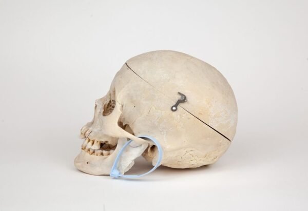 Medical Skull (0268)  - Image 3