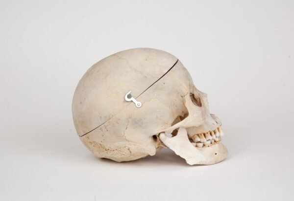 Medical Skull (0268)  - Image 2