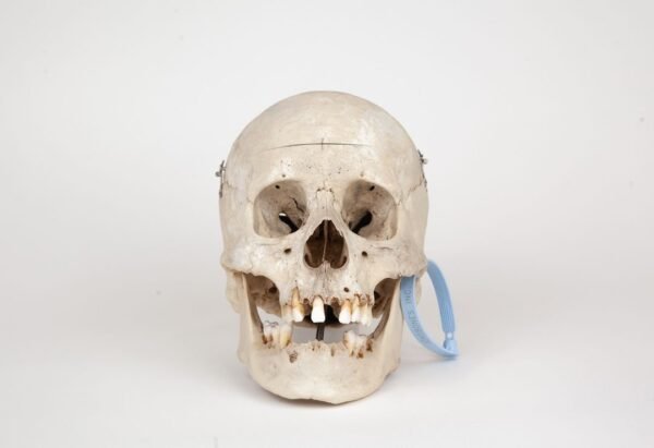 Medical Skull (0270)