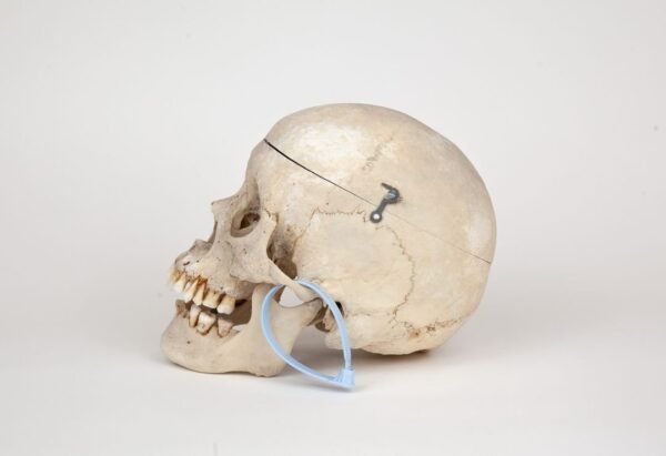 Medical Skull (0270) - Image 3