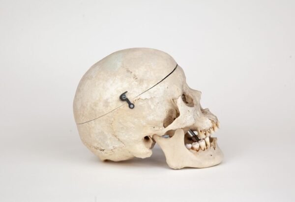 Medical Skull (0270) - Image 2