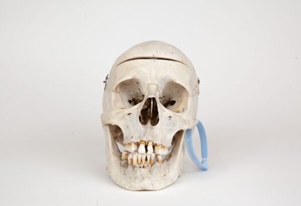 Medical Skull (0272) 