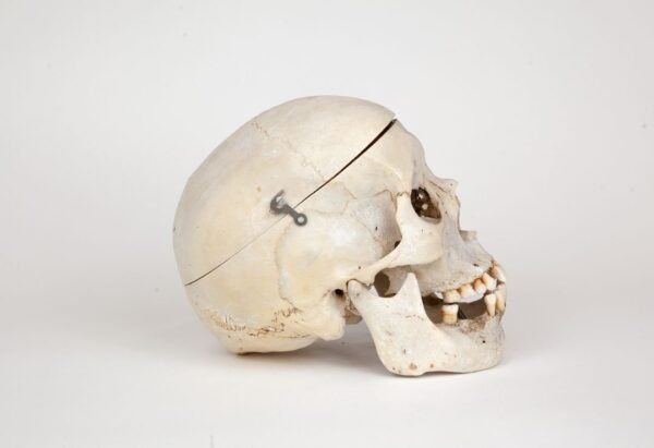 Medical Skull (0272)  - Image 2