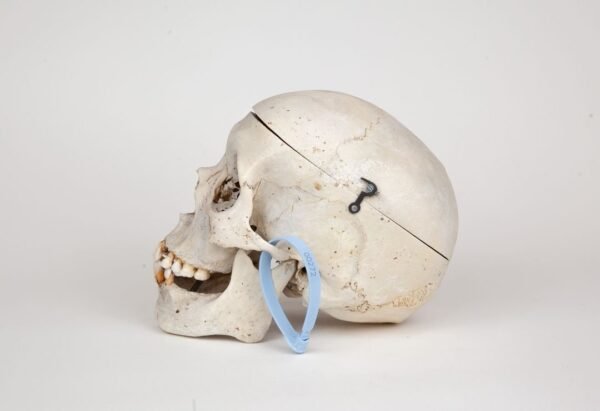 Medical Skull (0272)  - Image 3