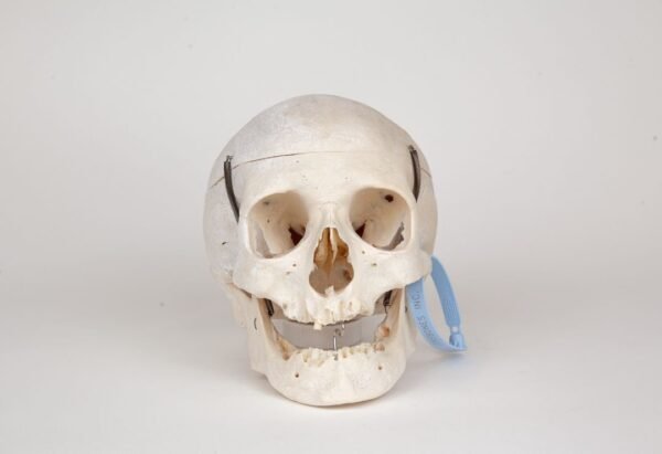 Medical Skull (0280) 