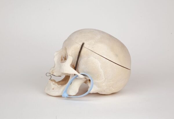 Medical Skull (0280)  - Image 3