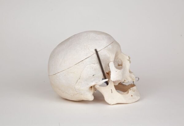 Medical Skull (0280)  - Image 2