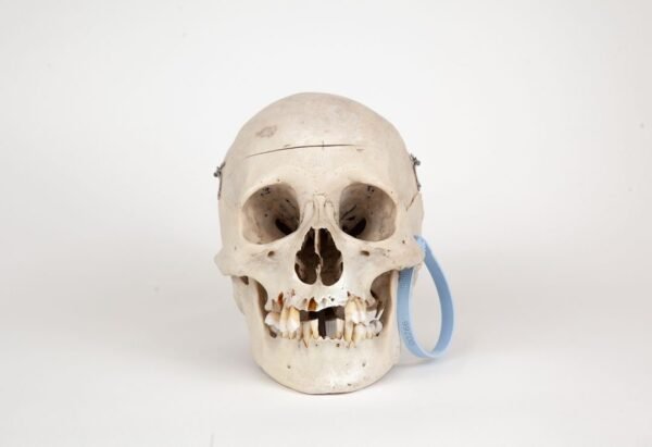 Medical Skull (0266) 