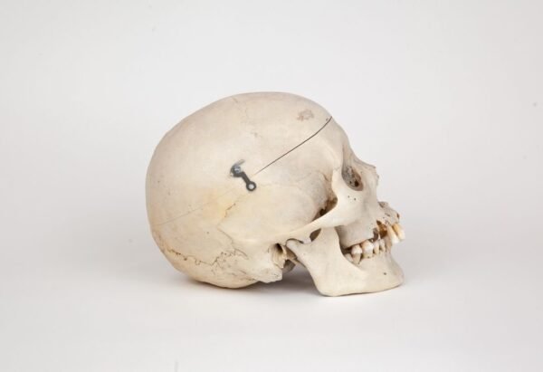 Medical Skull (0266)  - Image 2