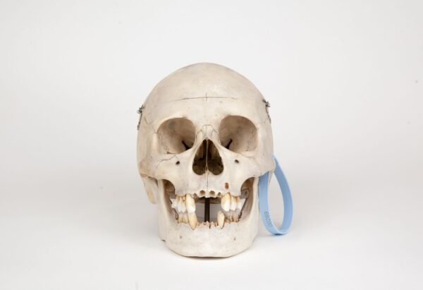 Medical Skull (0269)