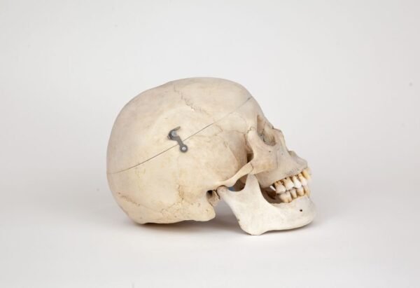 Medical Skull (0269) - Image 2