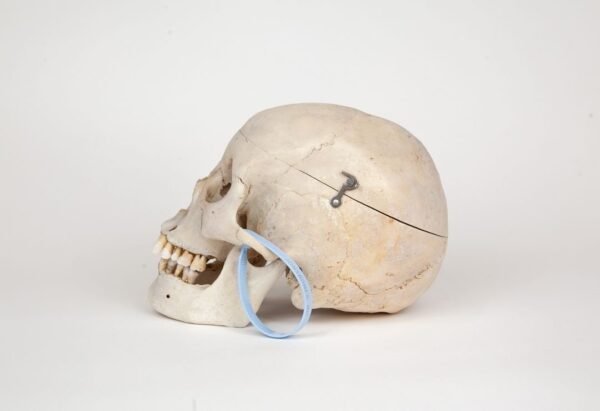 Medical Skull (0269) - Image 3