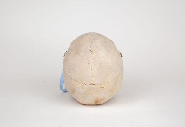 Medical Skull (0269) - Image 4