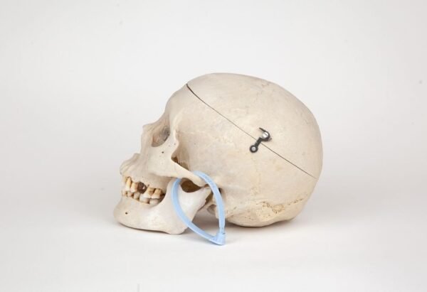 Medical Skull (0271) - Image 3