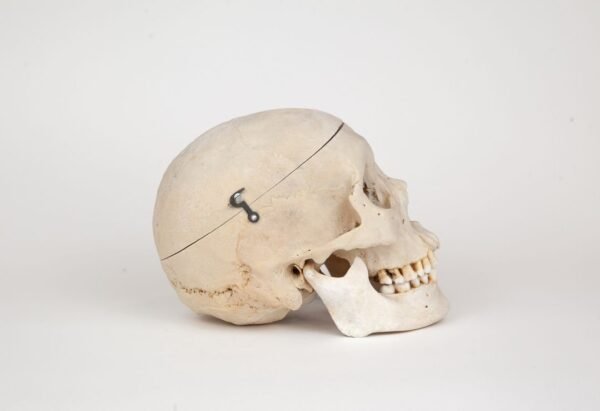 Medical Skull (0271) - Image 2