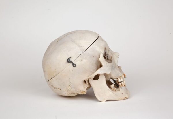 Medical Skull (0273) - Image 2