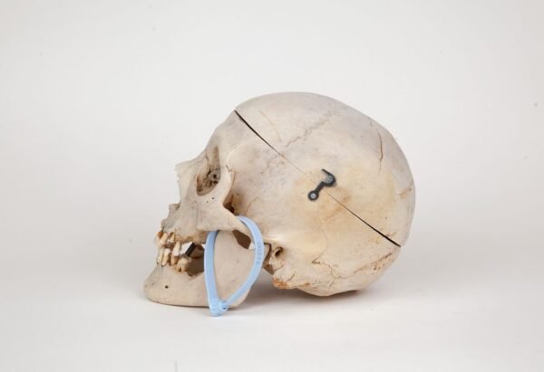 Medical Skull (0273) - Image 3