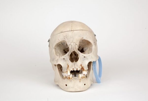 Medical Skull (0274)