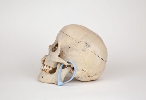 Medical Skull (0274) - Image 3