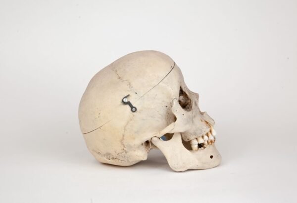 Medical Skull (0274) - Image 2