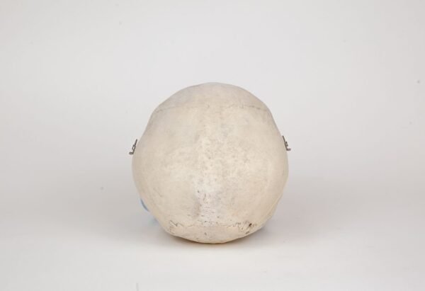 Medical Skull (0275) - Image 4