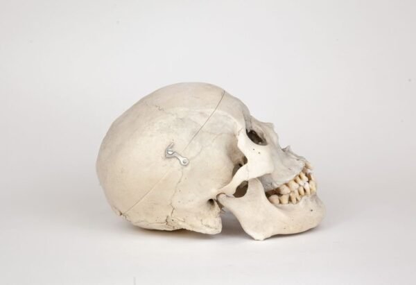 Medical Skull (0275) - Image 3