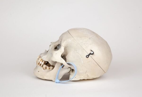 Medical Skull (0275) - Image 2