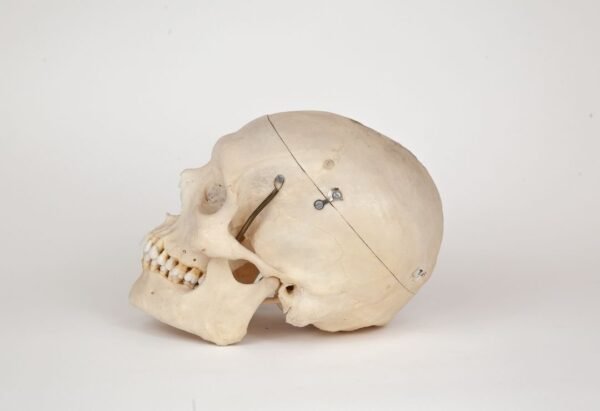 Medical Skull (0277) - Image 2