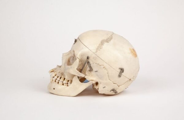 Medical Skull (0260) - Image 3