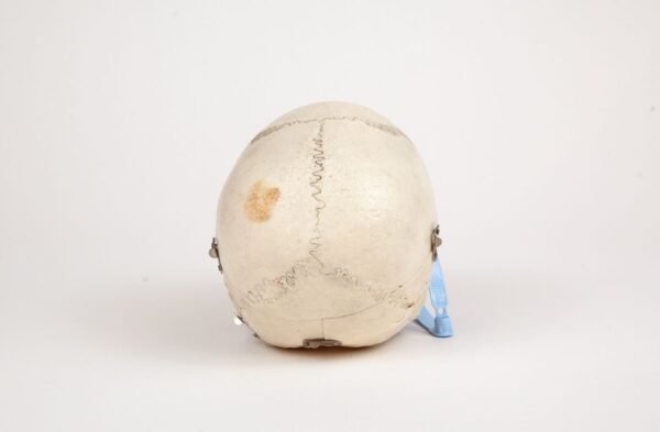 Medical Skull (0260) - Image 4