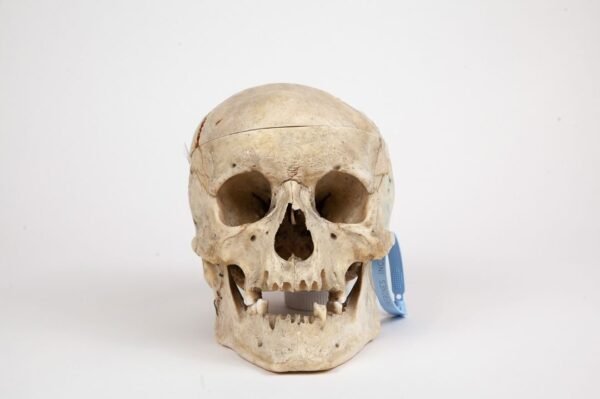 Medical Skull (0263)