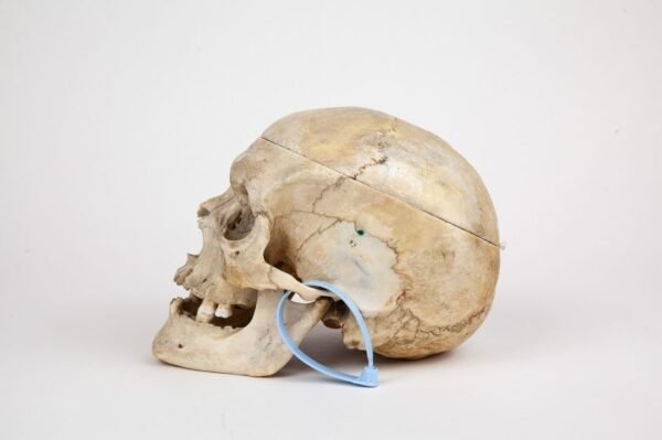 Medical Skull (0263) - Image 3