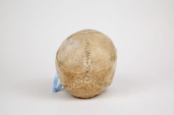 Medical Skull (0263) - Image 4