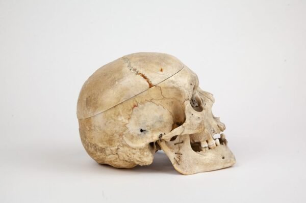Medical Skull (0263) - Image 2