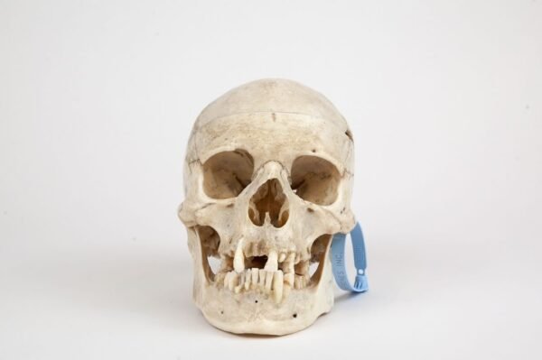 Medical Skull (0264