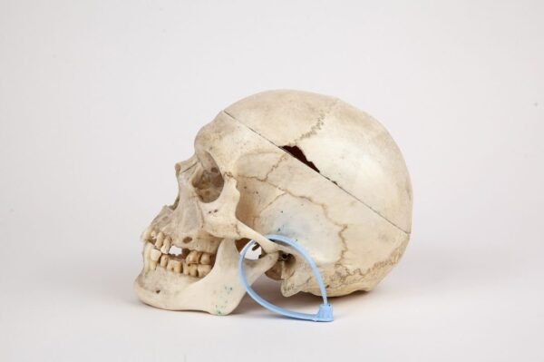 Medical Skull (0264 - Image 3