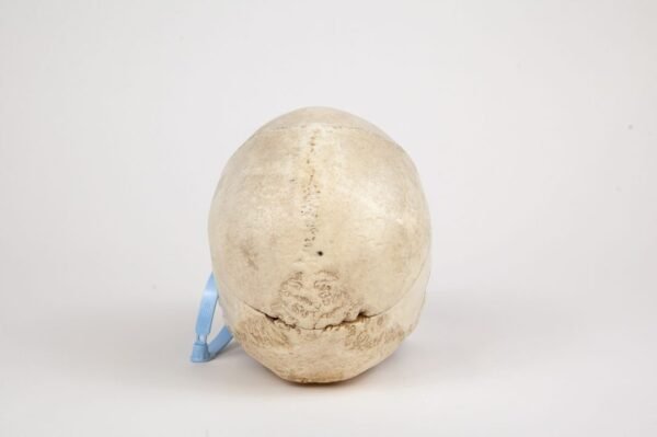 Medical Skull (0264) - Image 4