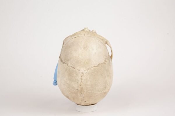 Medical Skull (0264 - Image 4