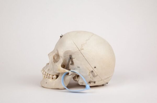 Adolescent Medical Skull (0265) - Image 3